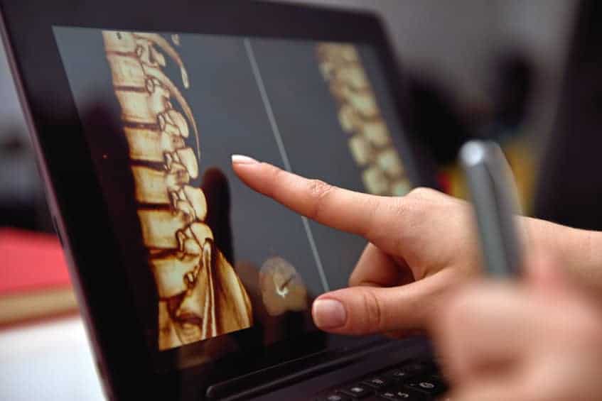 spine xray radiologist