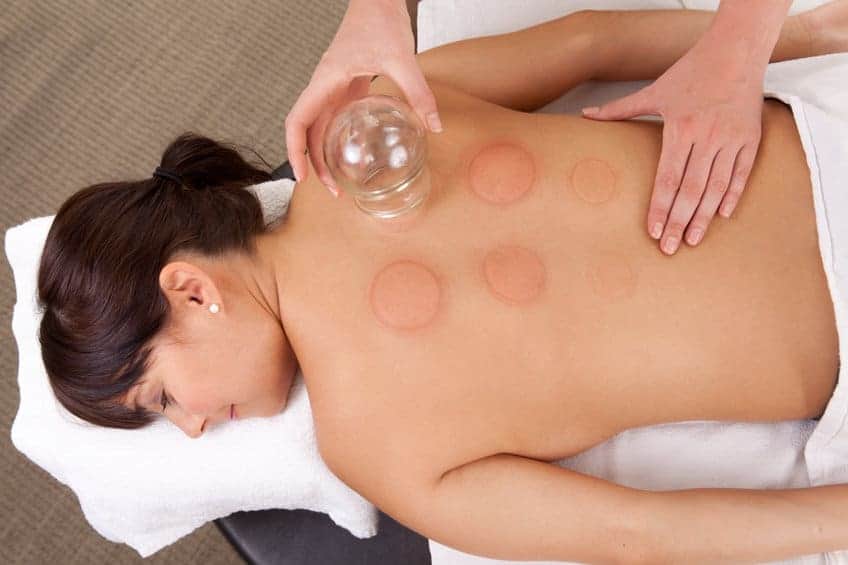 tulsa cupping therapy